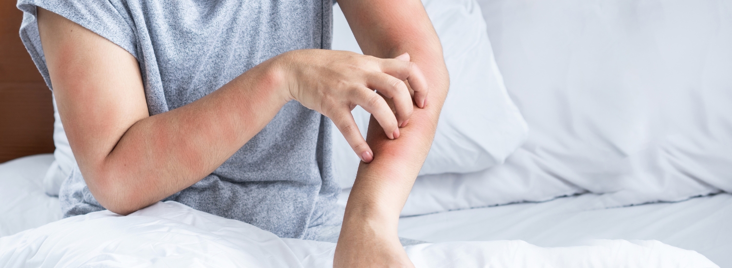 sudden skin rash causes