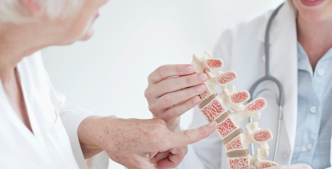 Osteoporosis Prevention: Prevention Tips