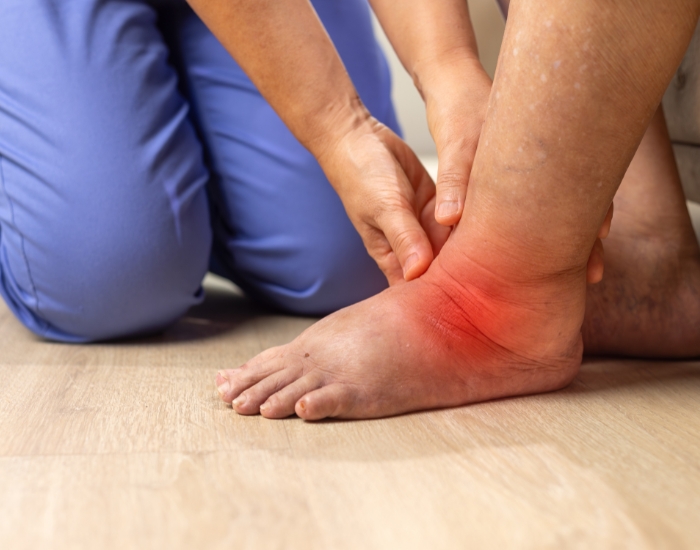 what causes swollen feet and legs in adults